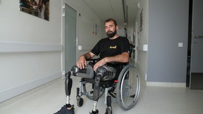 У Львові 41-річному захиснику встановили протези ніг із електронними колінами