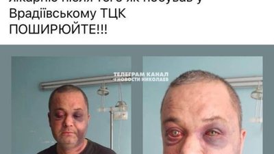 У Врадіївці скандал: мешканці звинувачують співробітників ТЦК у побитті чоловіка