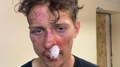 У Києві побили військового