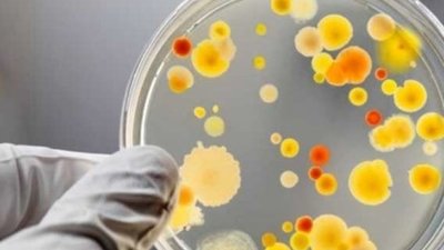 У Львові відвідувачів їдальні нагодували сальмонелою