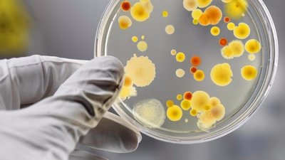 У Львові припинено функціонування дитсадка де стався спалах гострої кишкової інфекції -  Держпродспоживслужба