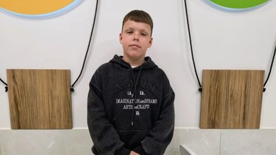 У Львові лікарі витягли рибальський гачок з ока 12-річного хлопця