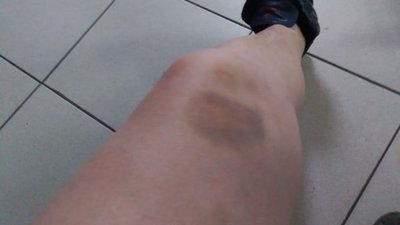 У Москві поліція побила жінку, яка відмовилася зняти хрестик (ФОТО)