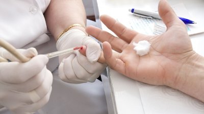 Велику кількість випадків COVID-19 на Рівненщині пов’язують із якісною діагностикою
