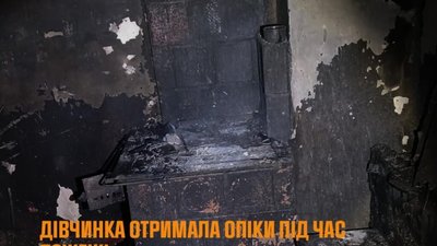 На Львівщині дівчина отримала опіки