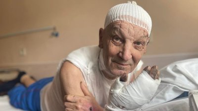 Вибрався із палаючого дому. У Львові лікують 75-річного чоловіка із Попасної