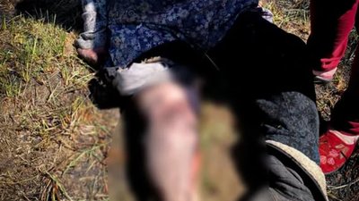 На Львівщині під час пожежі сухої трави постраждала жінка