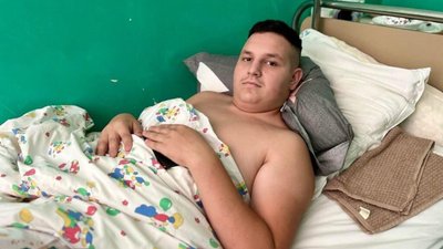 У Львові лікарі врятували 15-річного мотоцикліста, який потрапив у важку ДТП