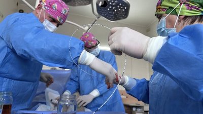 У Львові за допомогою лазера врятували чоловіка