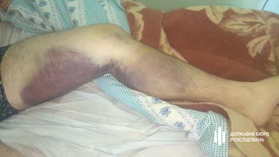 У Миколаївському відділі поліції жорстоко побили чоловіка (ФОТО)