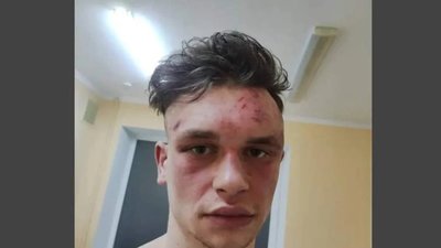 У Львові поліцейські побили стендапера у Винниківському лісі