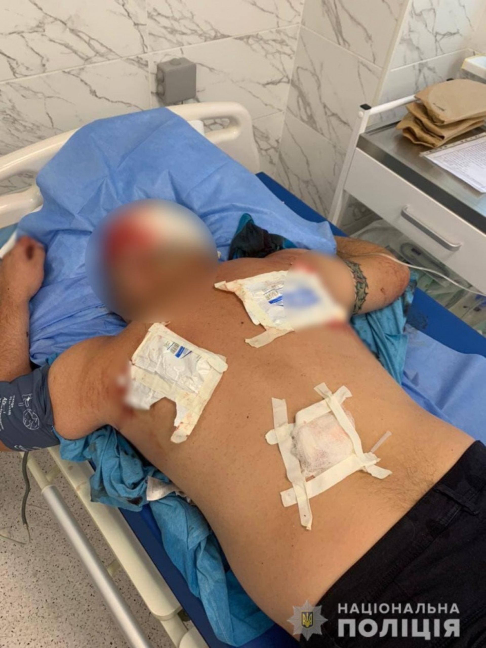 У Черкасах сталася стрілянина, двоє постраждалих
