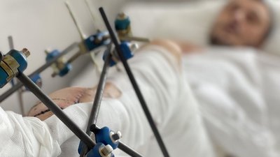 Львівські лікарі провели унікальну реконструктивну операцію (ФОТО)
