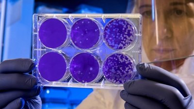 В Африці розробили швидкий тест на коронавірус вартістю $1