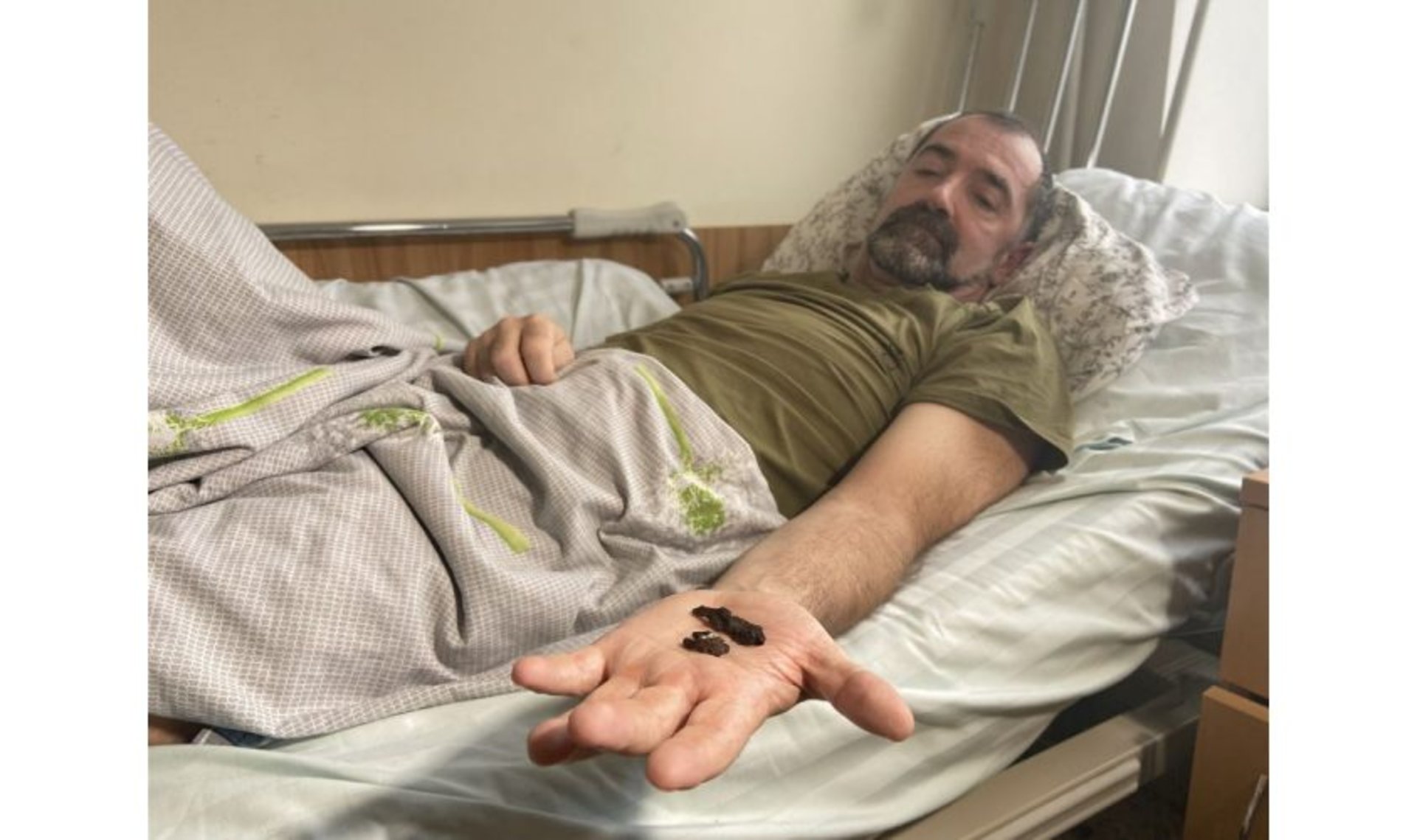 Львівський історик, який потрапив під мінометний обстріл, знову вчиться ходити