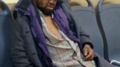Медики в шоці: львівському безхатьку роблять рентген і томографію 52 рази на рік (ФОТО)