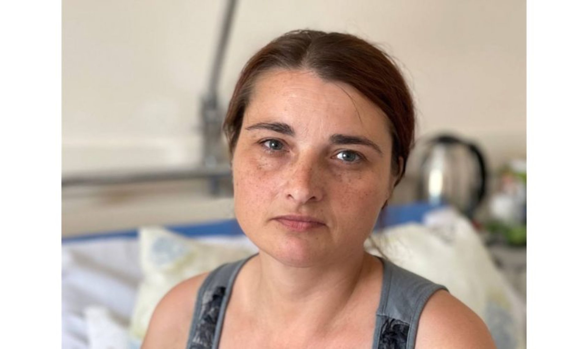 Львівські медики лікують жінку з Донеччини, яку через масивні травми ледь вдалося врятувати