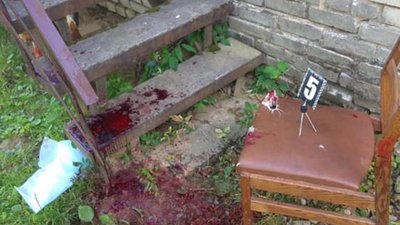 На Львівщині пацієнт накинувся з ножем на лікаря у стоматологічному  кабінеті (ФОТО)