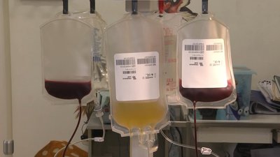 У Львові медики готуються до проведення операцій з трансплантації кісткового мозку (ВІДЕО)