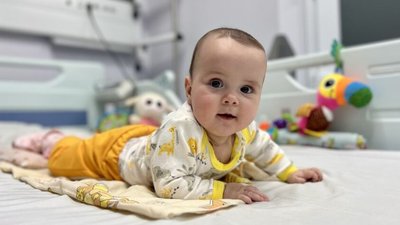 У Львові прооперували немовля з дуже рідкісною аномалією судин головного мозку