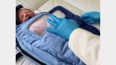 Пологовий будинок Львова отримав спеціальні грілки для передчасно народжених дітей