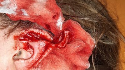 На Львівщині домашній пес відгриз частину вуха дівчинці (ФОТО)