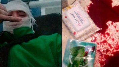 Поліція закрила провадження щодо нападу праворадикалів на неповнолітнього у Львові