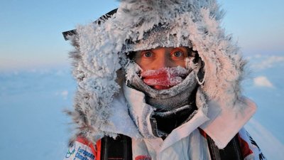 На Жовківщині чоловік обморозив кінцівки