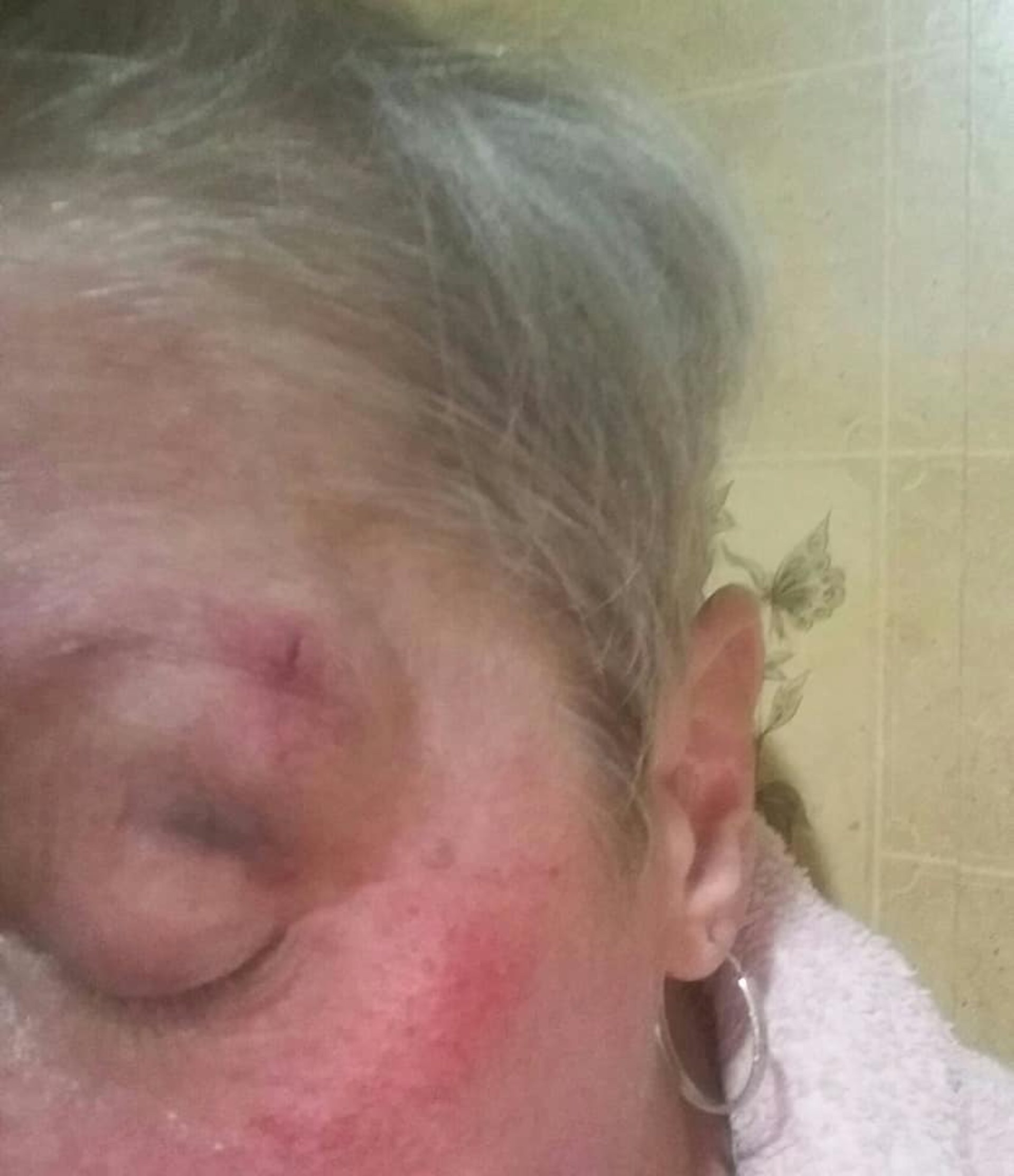 У Львові водій трамваю розбила жінці обличчя