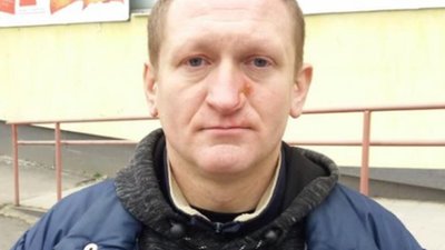 У Трускавці психічнохворий чоловік вбиває перехожих (ФОТО)