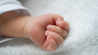 У Львові в одномісячного немовляти з COVID-19 виявили токсичне ураження шкіри